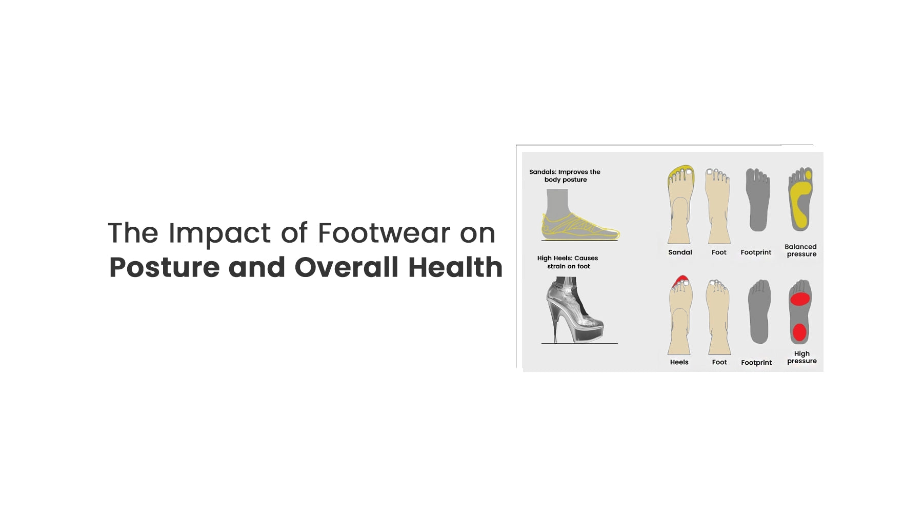 The Impact of Footwear on Posture and Overall Health: Importance of Choosing the Right Sandals