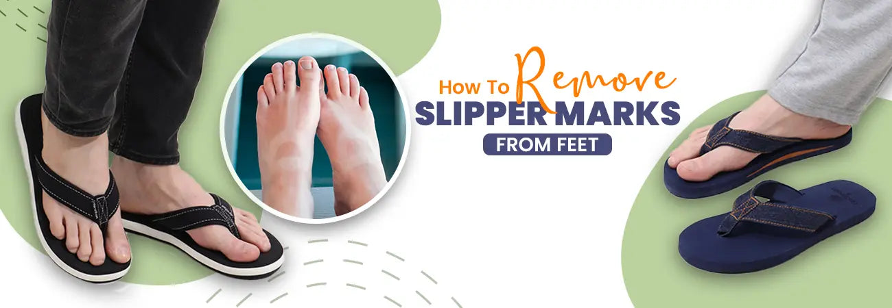How to remove slippers mark from feet